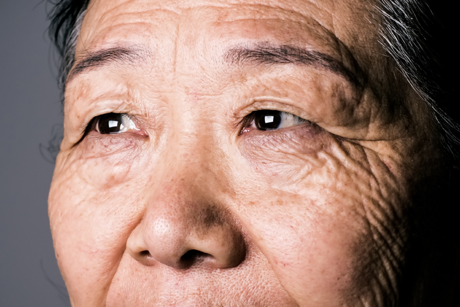 A close up of the face of an older adult, including the eyes and nose.