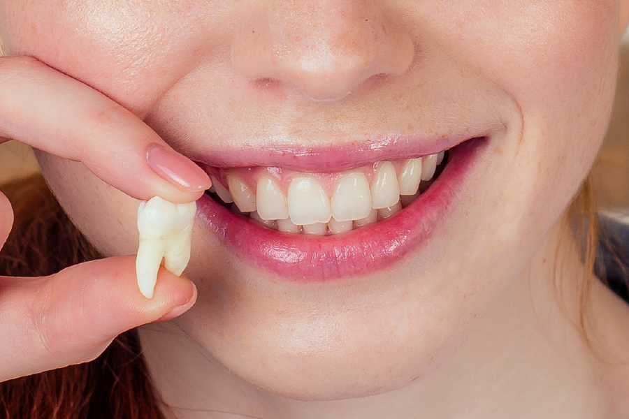 Person smiling and holding a wisdom tooth.