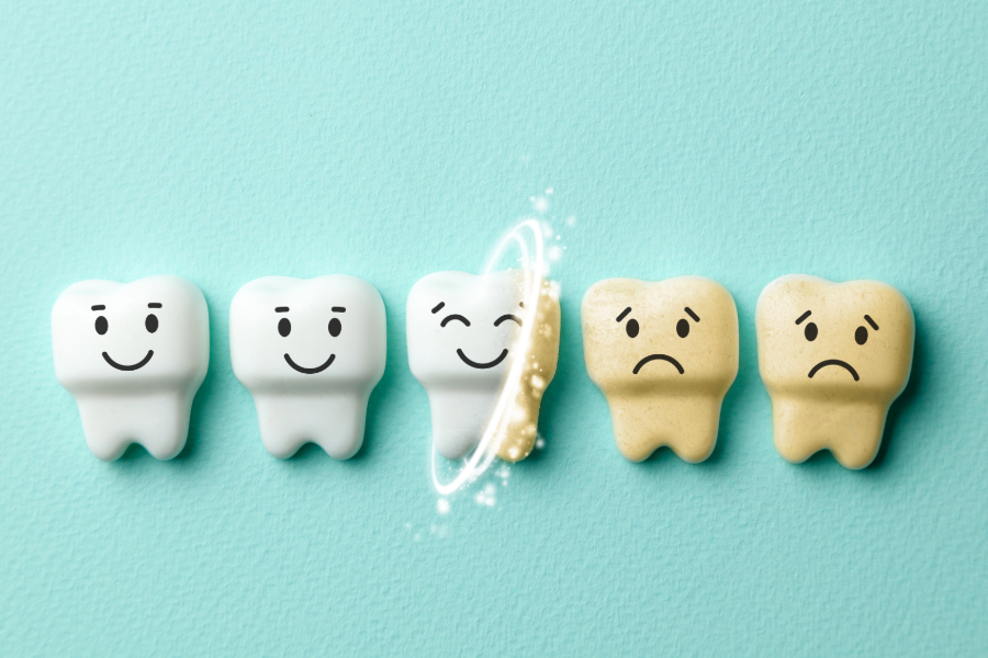 illustration of teeth in various shades of white